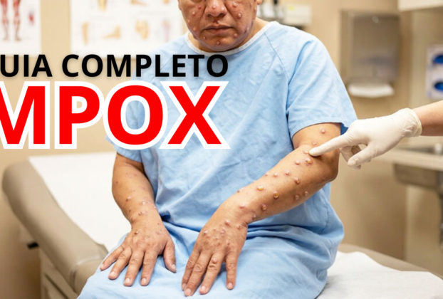 MPOX em 2026 Brasil Mantém Vigilância Ativa Enquanto OMS Monitora Novas Variantes